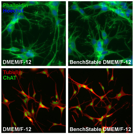 Effective differentiation in SH-SY5Y cells cultured in BenchStable™ Media