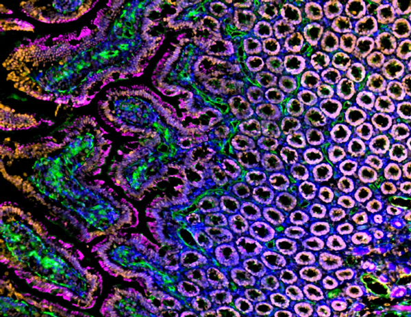 Immunofluorescent analysis of Sprague Dawley rat intestine, duodenum frozen sections with Histone H3 (orange), blood vessels (lectin, green), actin (magenta), and nuclei (blue) overlays