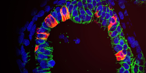 Optimizing Organoid Culture Conditions