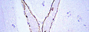 Primary Antibodies for Western Blot